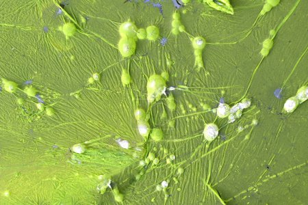 Colonia de bacterias verdes formando burbujas en aguas residuales contaminadas