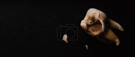 Photo for Tooth decay on black background. Macro shot of a decayed teeth till root after extraction of dentist. Real tooth anatomy due lack of care. Top view of caries teeth texture on black paper. Dental care. - Royalty Free Image