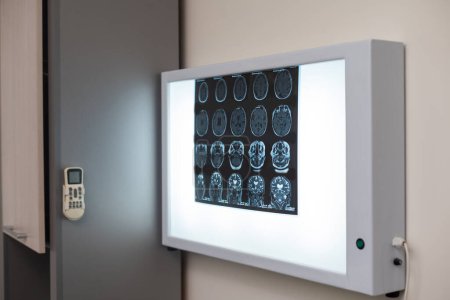 Foto de En el paciente de laboratorio médico se somete a una resonancia magnética o un proceso de exploración por TC bajo supervisión del médico y el radiólogo en la sala de control, observan el procedimiento y monitorean los resultados de la actividad cerebral. - Imagen libre de derechos
