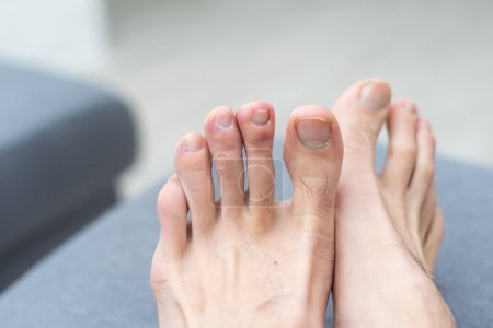 Foto de Hombre dedos de los pies con el pelo y las uñas sucias - Imagen libre de derechos