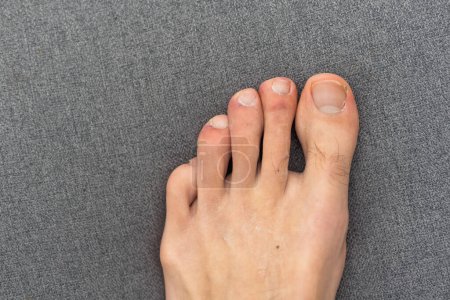 Foto de Joven pie peludo masculino blanco con uñas de los pies descuidadas. - Imagen libre de derechos