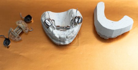 Téléchargez les photos : Modèle de gypse coulée dentaire des mâchoires humaines. Dents tordues et morsure distale. plaque pour la dent. - en image libre de droit