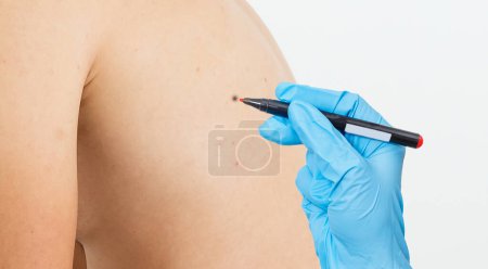 Téléchargez les photos : Vue recadrée du dermatologue examinant la peau du patient à la loupe en clinique. Photo de haute qualité - en image libre de droit