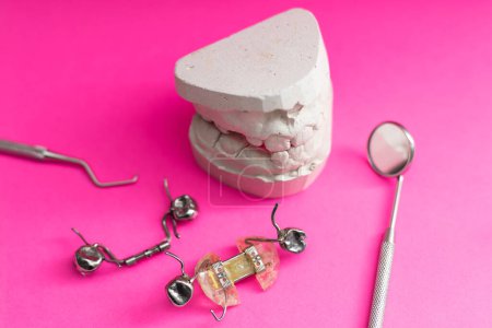 Téléchargez les photos : Modèle de gypse coulée dentaire des mâchoires humaines. Dents tordues et morsure distale. plaque pour la dent. - en image libre de droit