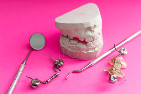 Zahnguss Gips Modell Gips gegossen stomatologischen menschlichen Kiefer Prothetik-Labor. Zahnplatte.