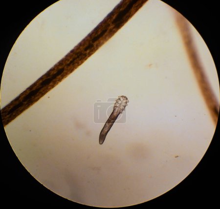 Foto de Demodex folliculorum - ácaro parásito en las pestañas de un ojo humano, microscopio - Imagen libre de derechos