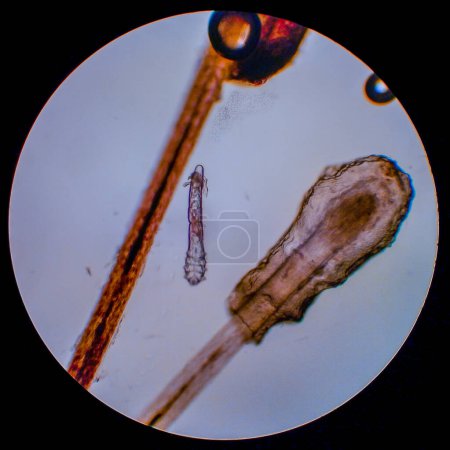 Foto de Demodex folliculorum - ácaro parásito en las pestañas de un ojo humano, microscopio - Imagen libre de derechos