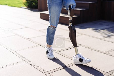Photo for Portrait of young woman with prosthetic leg staying in city. Woman with prosthetic leg. Woman with leg prosthesis equipment. - Royalty Free Image