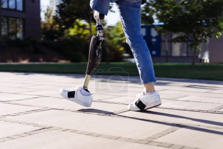 Photo for Close up of woman student with prosthetic leg walking in university campus. Woman with bionic leg. Woman with leg prosthesis equipment. - Royalty Free Image
