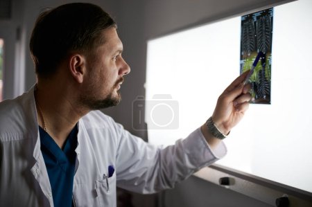 Side view of serious doctor studying MRI results. Male specialist working in hospital, carrying out description of radiographs of patient, pointing by pen. Concept of medicine and hospital.