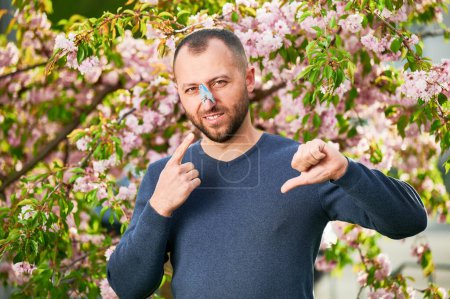 Photo for Man allergic suffering from seasonal allergy at spring. Bearded man with clothespin clipped to his nose - symbolic gesture of his inability to breathe due to nasal congestion, giving thumbs down. - Royalty Free Image