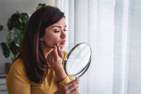 Téléchargez les photos : Femme se regardant dans le miroir à la maison debout près de la grande fenêtre. Elle est préoccupée par l'acné - en image libre de droit