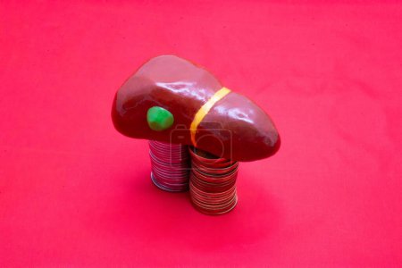 Plastic model of diseased liver with gallbladder on two piles of coins on white background. Medicine, treatment, transplantation and economic connection concept