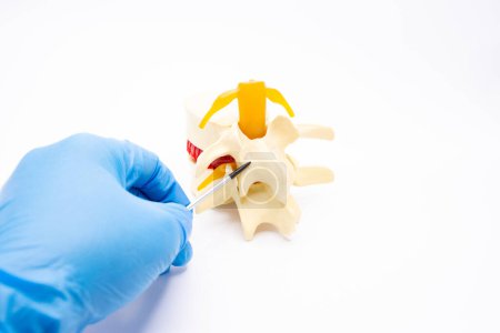 Los médicos o científicos señalan que el modelo realista de la columna vertebral es el componente anatómico óseo del órgano. Posibles localizaciones de enfermedades de la columna vertebral, como espondilosis, espondiloartropatía, retrolistesis