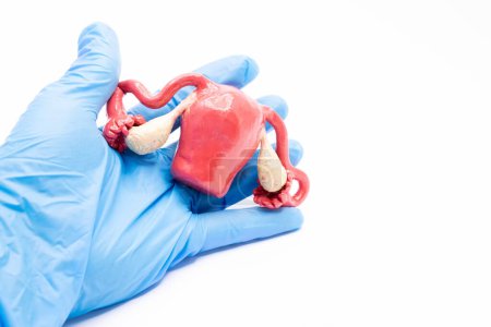 A doctor in blue medical gloves holds a mock-up of the uterus on a white background. For use in medical presentations, advertising.