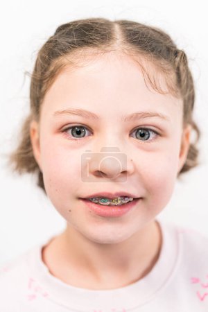 Photo for Little girl with rainbow braces smiling at the camera. - Royalty Free Image