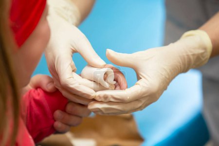 Photo for The hands of the doctor bandage the sore finger with a bandage of the child. Injury and wound on the finger in children - Royalty Free Image