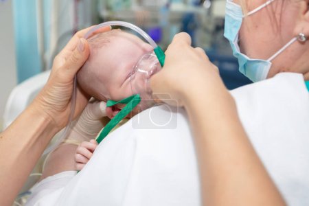 Foto de Bebé con una máscara de oxígeno en la unidad neonatal.Bebé use máscara de oxígeno - Imagen libre de derechos