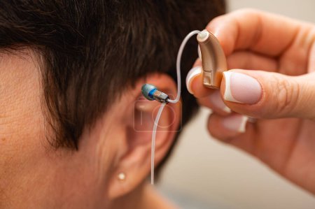 Una mujer se prueba un audífono escondido en su oído sobre un fondo claro. Restauración del oído. Medios técnicos
