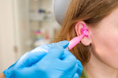 Foto de Un médico llena el conducto auditivo de un paciente con un material de silicona, de color rosa, hecho con una jeringa para hacer tapones auditivos en una clínica auditiva. Producción de insertos a pedido - Imagen libre de derechos