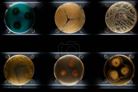 Foto de Diferentes tipos de bacterias, mohos y hongos en placas de Petri - Imagen libre de derechos