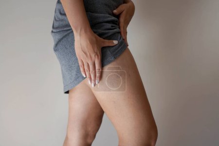 Photo for Painful varicose veins on woman legs - Royalty Free Image