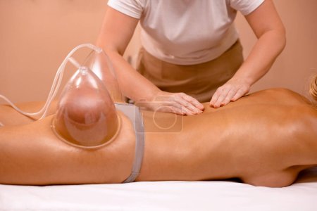Masseurin Hände macht Sportmassage während Vakuum-Therapie für Gesäß im Schönheitssalon