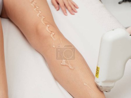 removing hair with laser treatment