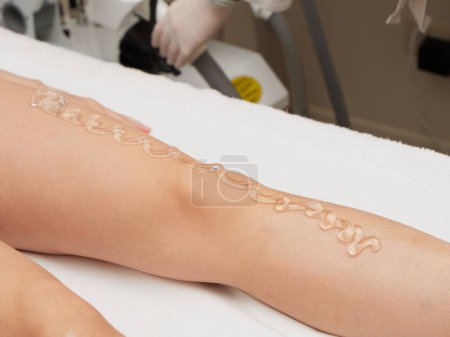 Photo for Removing hair with laser treatment - Royalty Free Image