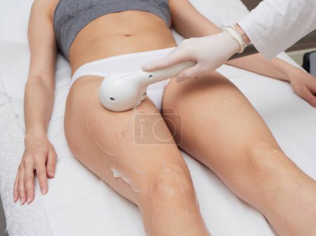 Photo for Beautician Removing Hair Of Young Womans body by laser treatment - Royalty Free Image