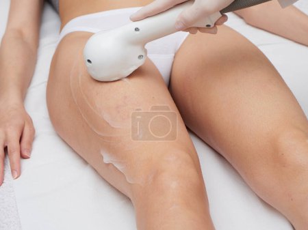 Photo for Beautician Removing Hair Of Young Womans body by laser treatment - Royalty Free Image