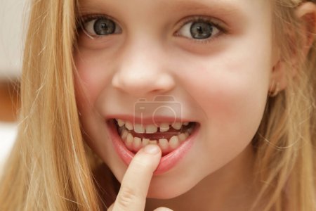 Photo for Cute preschool girl showing a loose primary (baby) tooth - Royalty Free Image