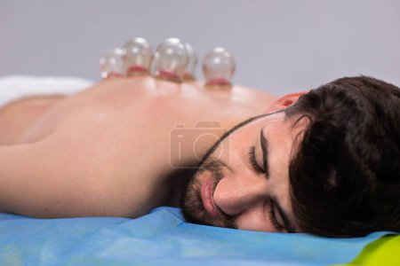Photo for Charismatic guy at spa salon have a relaxed day he have a back massage the therapist using a big vacuum cup to massage all back muscles. Portrait - Royalty Free Image