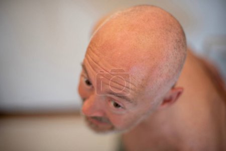 Foto de Psicópata afeitado cabeza y barba en la clínica - Imagen libre de derechos