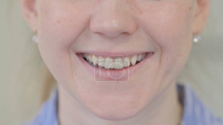 Téléchargez les photos : Gros plan de la jeune femme souriante Lèvres et dents - en image libre de droit