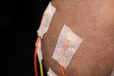Téléchargez les photos : Vue rapprochée du placement des électrodes du cuir chevelu et des bandes de papier pendant l'électroencéphalographie du cuir chevelu ou l'examen EEG. - en image libre de droit