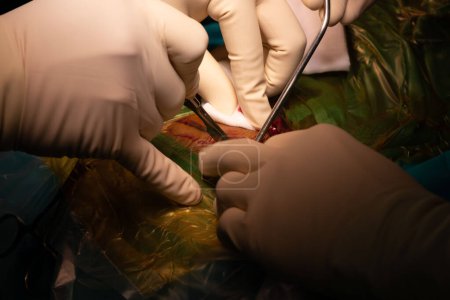 Téléchargez les photos : Main de médecin avec lame chirurgicale incision pendant la chirurgie en salle d'opération. - en image libre de droit