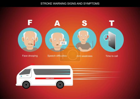 Ilustración de Signos y síntomas de advertencia de accidentes cerebrovasculares ilustración. - Imagen libre de derechos