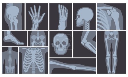 Illustration for Vector illustration of realistic set of many X-rays pictures of human body. Transparent X-ray photos on white background. - Royalty Free Image