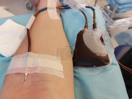 Téléchargez les photos : Bras de l'homme sur lit d'hôpital avec aiguille coincée dans l'avant-bras pendant l'opération médicale - en image libre de droit
