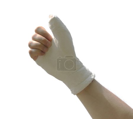 oung man hand in cast with fractured thumb bone awaits healing on white background