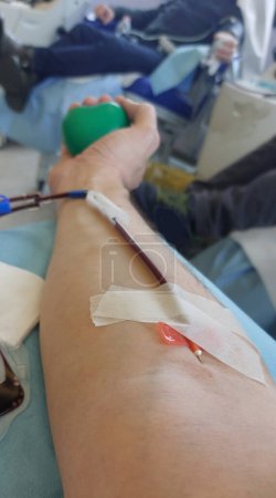 Limb of the volunteer blood donor during the transfusion with the needle inserted into the arm and the tube