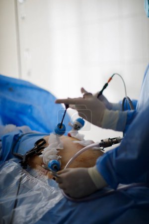 Foto de Manos de médicos que realizan operaciones de laparoscopia. Foto de alta calidad - Imagen libre de derechos