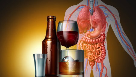 Drinking Health Danger concept as beer wine and spirits alcoholic glasses and bottle as a medical riskon the human body as cancer or dangerous health care risk of alcohol drinks with 3D illustration elements.
