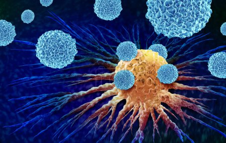 Leukozyten, die eine Krebszelle als Onkologie angreifen oder bösartiges Krebswachstum und Metastasen-Anatomie-Konzept als weiße Blutkörperchen im menschlichen Körper als 3D-Illustration.