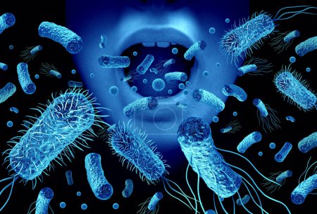Mundbakterien und Mundgeruch oder Mundgeruch mit Keimen als bakterielle Infektion mit offenem Mund als Gesundheitsproblem mit Lebensmittelvergiftung durch 3D-Illustrationselemente.