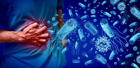 Foodborne Illness and Stomach Pains or stomachache with a painful digestive system ache as an abdominal illness or stomach infection with 3D illustration elements.