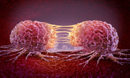 Metástasis Célula cancerosa y oncología o crecimiento canceroso maligno como células tumorales crecientes que se dividen y enfermedad maligna que se propaga metástasis en un órgano dentro del cuerpo humano como ilustración 3D.
