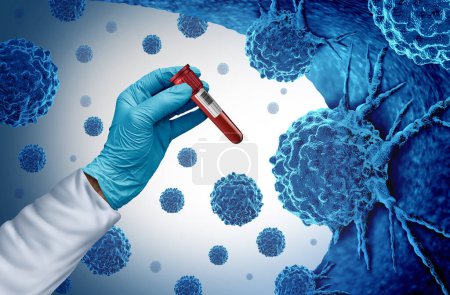 Test sanguin Multi Cancer et dépistage pour la détection précoce des cancers et des cellules malignes comme cancérogènes et génétique avec une cellule cancéreuse comme symbole d'immunothérapie et diagnostic de thérapie médicale comme illustration 3D.