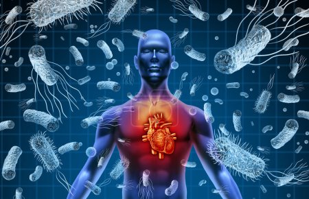 Herz und Bakterien oder bakterielle Endokarditis und Septikämie oder Sepsis als Blutvergiftung durch Keime mit 3D-Illustrationselementen.